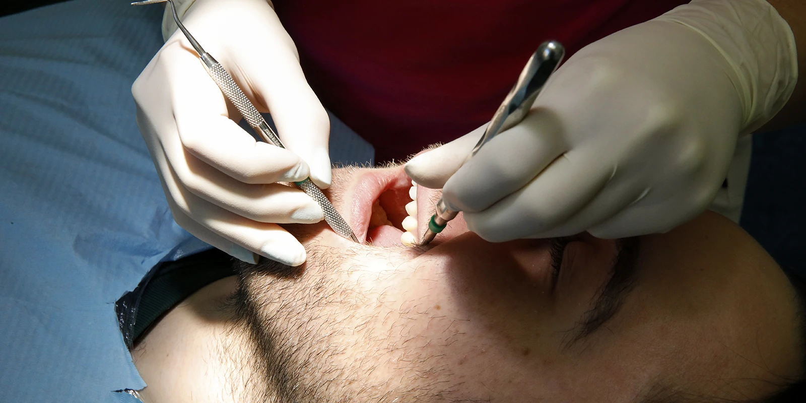 paradontologia-slider-studio-dentistico-chiaromonti